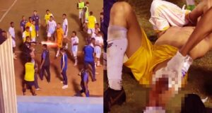 ব্রাজিলে পুলিশের গুলিতে এক ফুটবলার আহত হয়েছেন