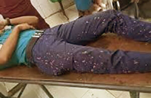 চট্টগ্রামে দুর্বৃত্তের হামলায় আইনশৃঙ্খলা বাহিনীর আহত ১২ সদস্য