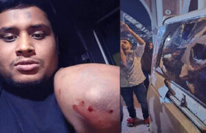 গাড়িতে হামলায় আহত হাসনাত আবদুল্লাহ