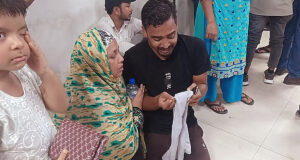 কাকা চিৎকার করে বলেন, ‘ওর দুই হাত আর মুখ পুড়ে গেছে!’