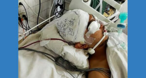 ‘কোন খুলি নেই, চাপ দিও না’, সেই মেডিকেল ছাত্র আকিব এখন কেমন আছে?