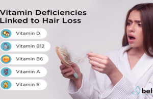 হঠাৎ চুল পড়া? এই ভিটামিনের ঘাটতিই এর কারণ হতে পারে